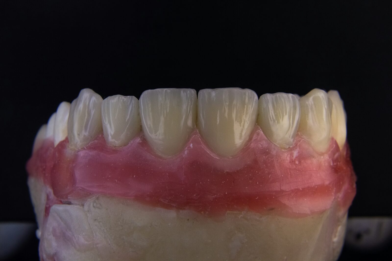 Dental model featuring an arch of white teeth and pink gum material.